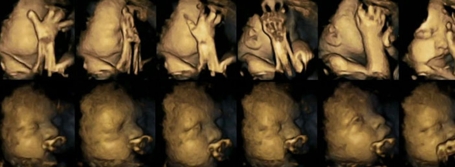 Dit doet een baby in de baarmoeder wanneer een zwangere vrouw rookt