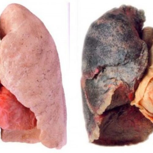 De beste natuurlijke manier om je longen van nicotine en teer te reinigen