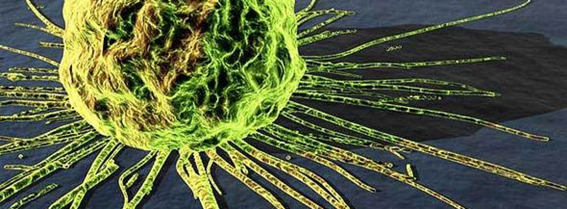 “Opzienbarende doorbraak”: Kijk hoe dit menselijk eiwit in realtime kankercellen doodt