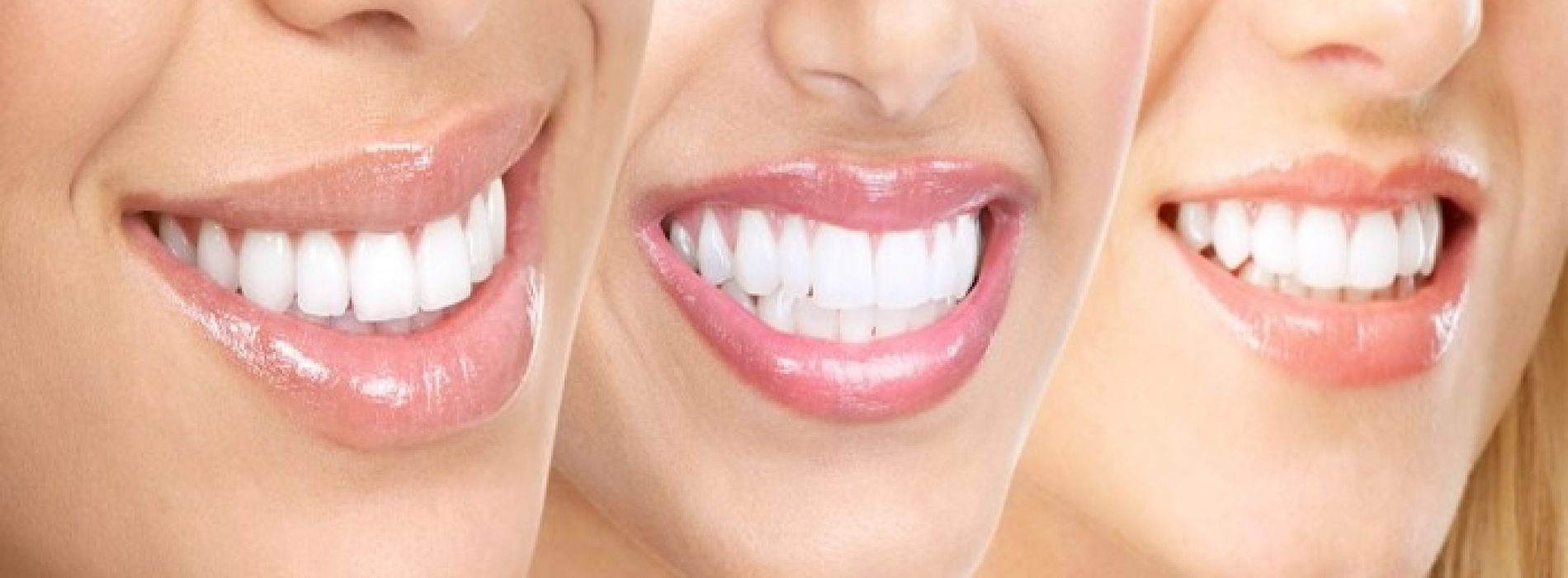 15 tips voor witte tanden op natuurlijke wijze