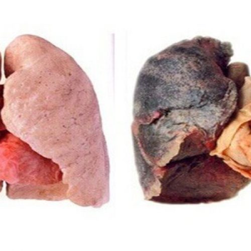 Tips voor schonere longen