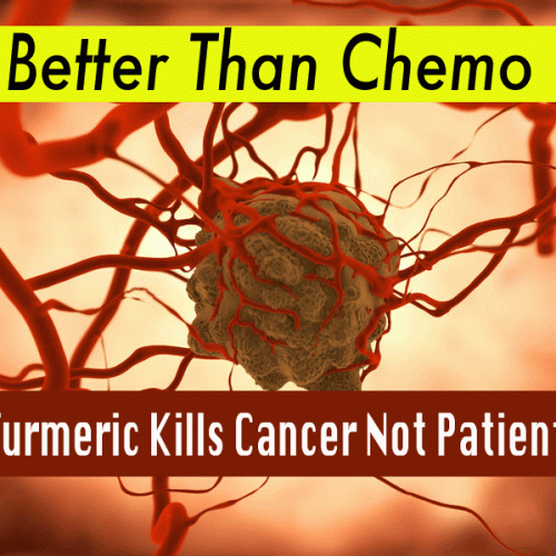 Beter dan chemotherapie: kurkuma doodt kanker in plaats van patiënten