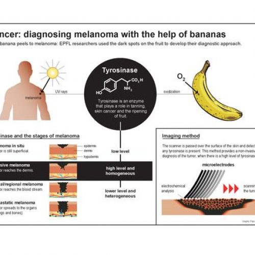 Bananen kunnen worden gebruikt om huidkanker op te sporen en te genezen