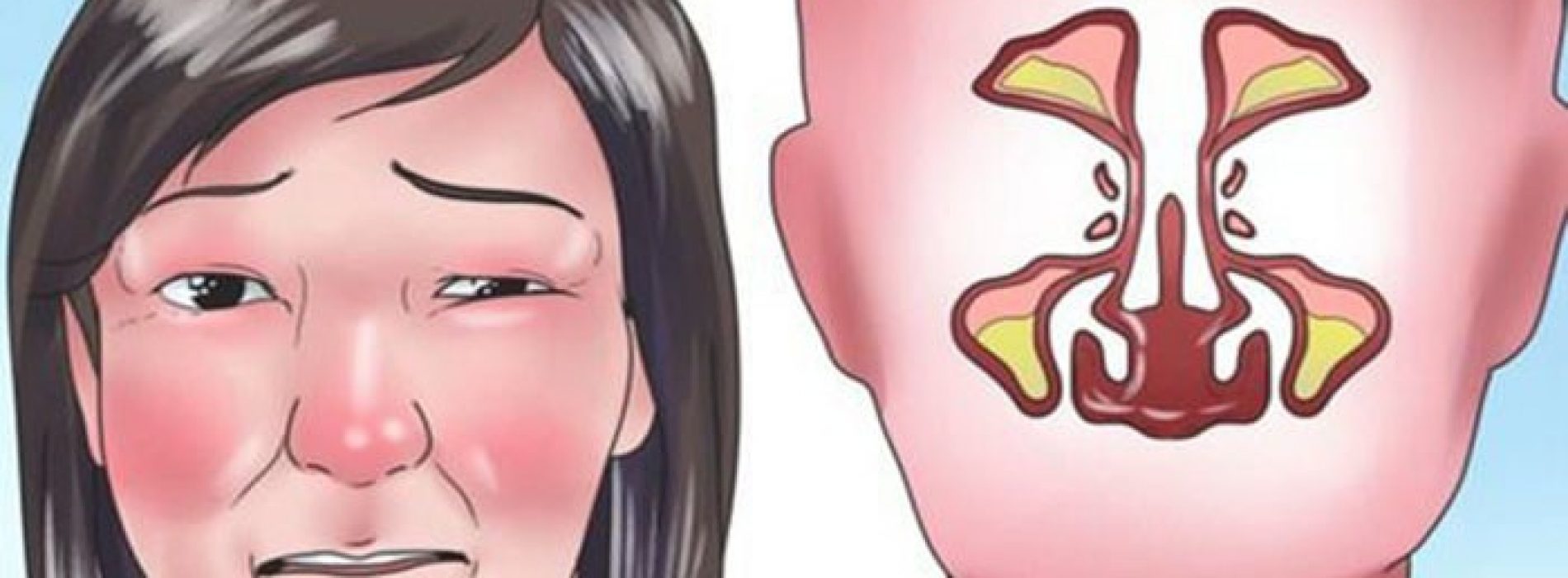 Gebruik deze geweldige truc om een verstopte neus binnen 2 minuten vrij te maken!