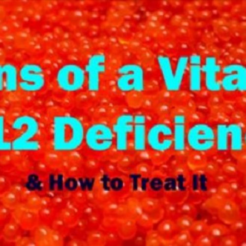 De belangrijke feiten die u moet weten over vitamine B12-tekort