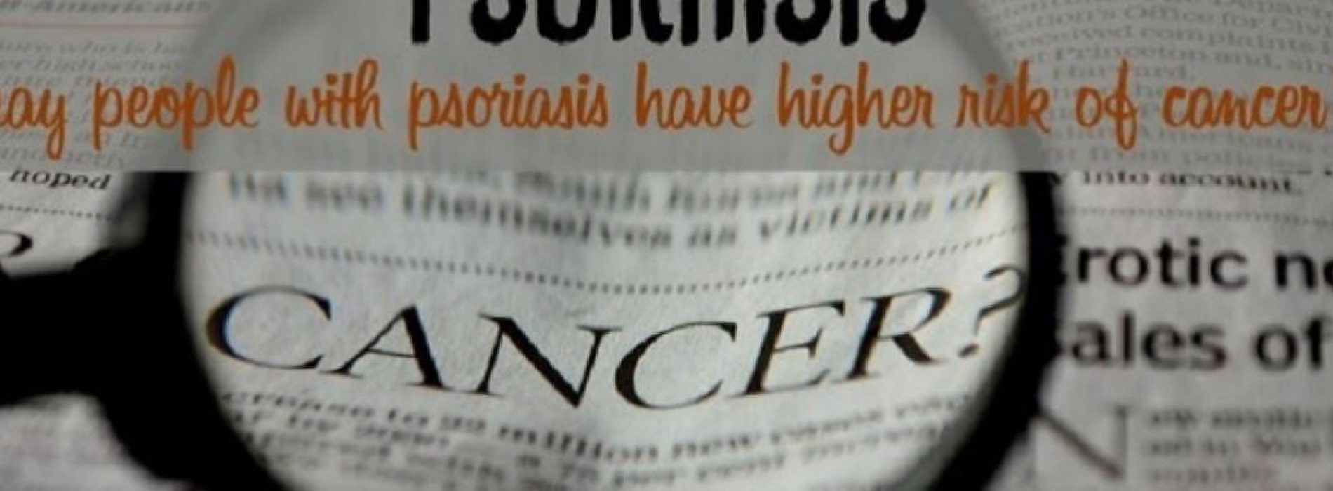 Studie wijst richting verhoogde kans op kanker bij Psoriasis