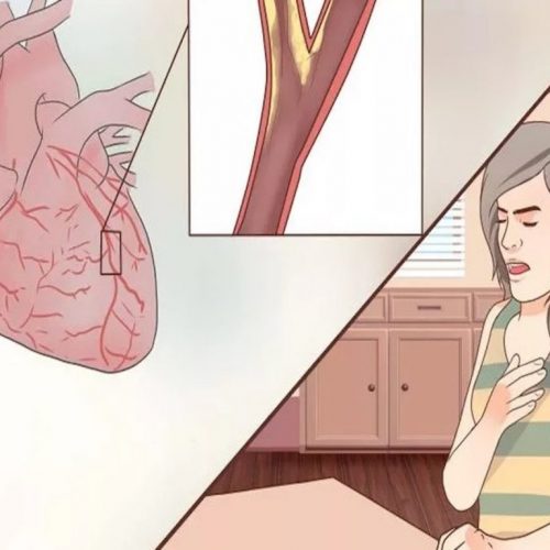 Opgelet: Stille hartaanval bedreigt vooral vrouwen! Dit zijn de symptomen.