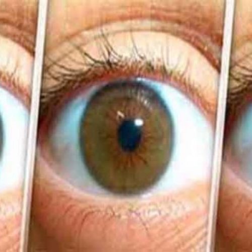 Natuurlijke recept om de ogen op te klaren, verminder staar en verbeter uw gezichtsvermogen in 3 maanden! Het is heel simpel!