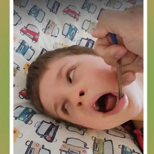 Kijk hier hoe snel cannabisolie een einde maakt aan de epileptische aanval van een 7-jarig jongetje