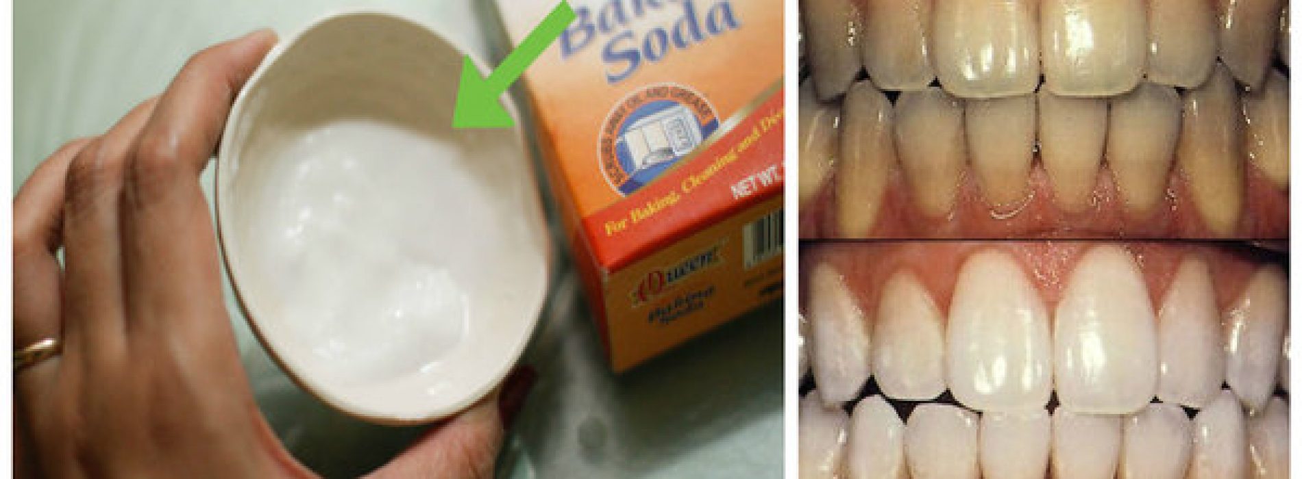 Kijk hoe je tanden wit worden in slechts 2 minuten met dit huismiddeltje