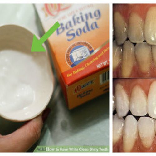 Kijk hoe je tanden wit worden in slechts 2 minuten met dit huismiddeltje