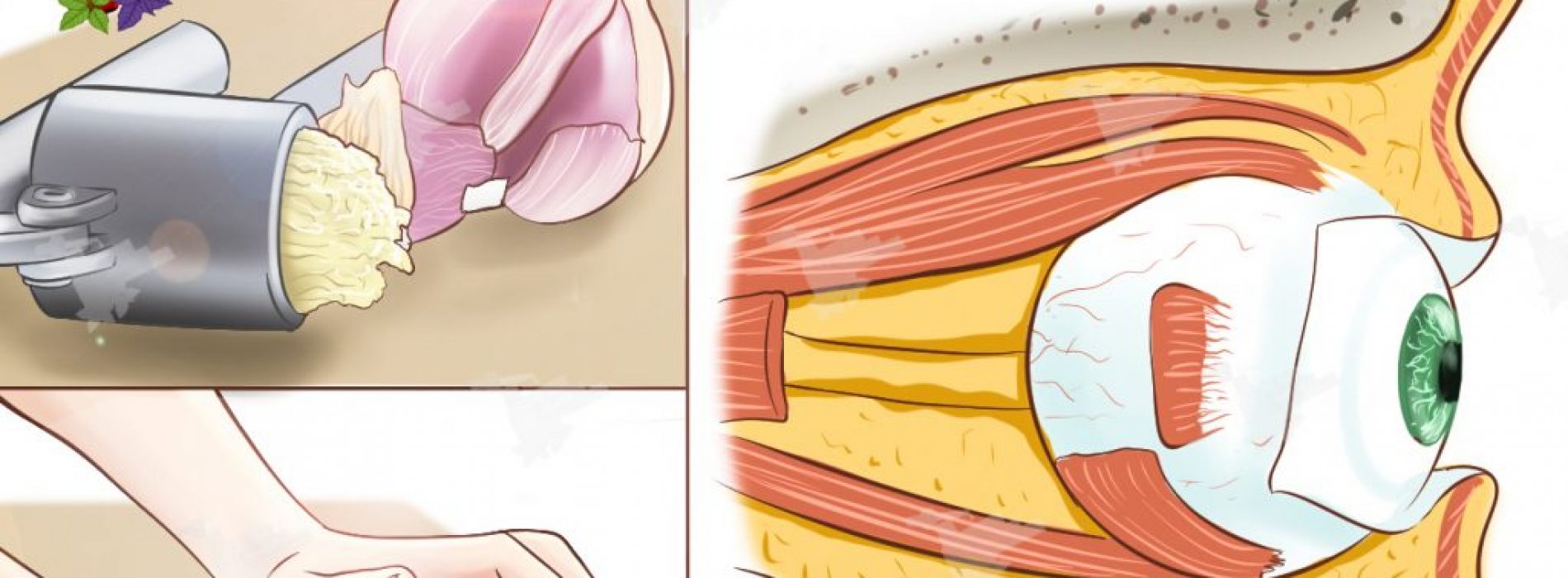 Hoe geperste knoflook te gebruiken om verlies van gezichtsvermogen terug te draaien zonder bril of chirurgie