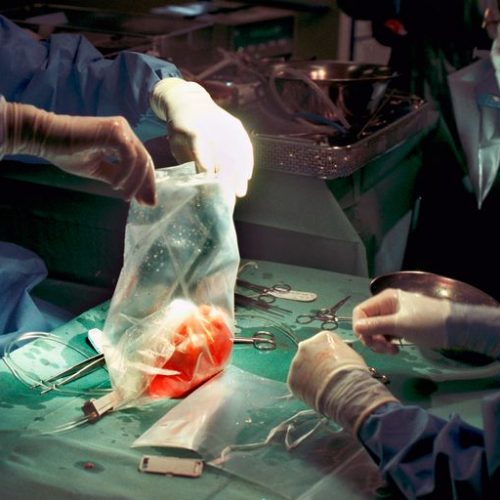 Wanneer artsen het echte verhaal over hersendood zouden vertellen, zou geen mens meer orgaandonor willen zijn