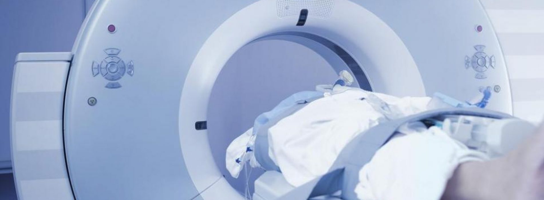 Kijk uit met CT-scans bij kinderen! Ze verviervoudigen de kans op hersentumoren!
