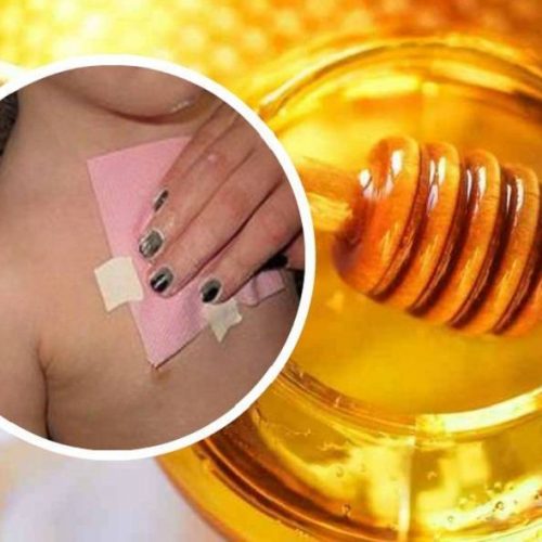 DIY Honing patch om hoest te genezen en slijm uit de longen te elimineren