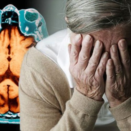 Als u niet genoeg slaap krijgt, versnelt u hersenschade in verband met de ziekte van Alzheimer, waarschuwen onderzoekers