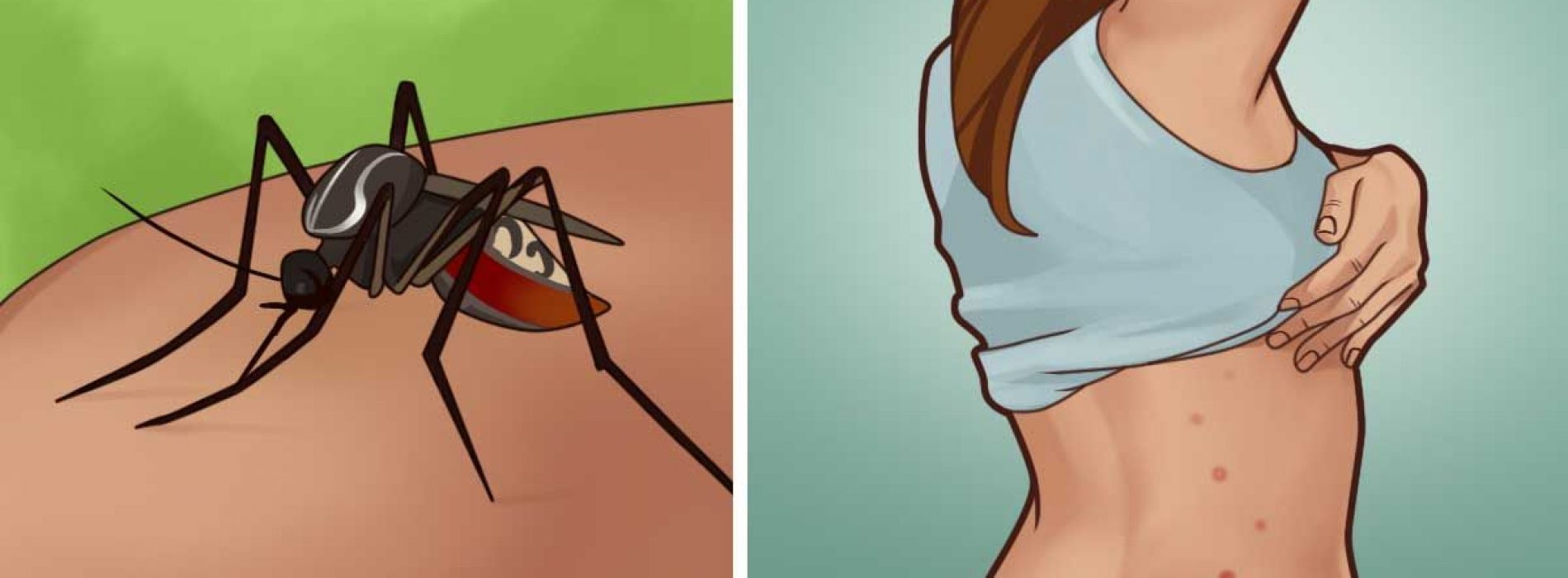 Hier is een eenvoudige manier om jezelf te redden van het feit dat je dit jaar levend wordt opgegeten door muggen