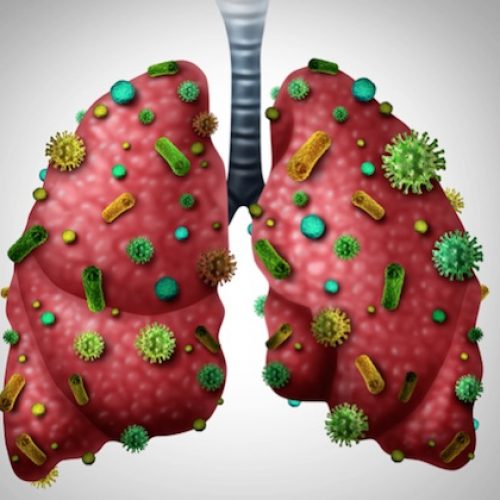 Ontgift uw longen: 8 must-do strategieën om uw ademhalingsproblemen te genezen
