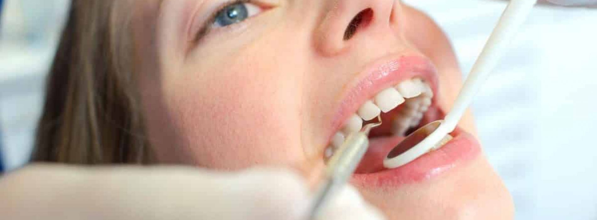 De link tussen kwik tandvullingen en chronische ziekte