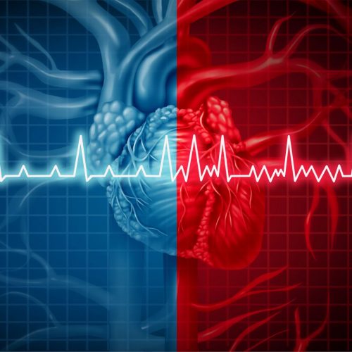 De meeste cardiologen schrokken toen ze de ware oorzaak van hartaanvallen ontdekten