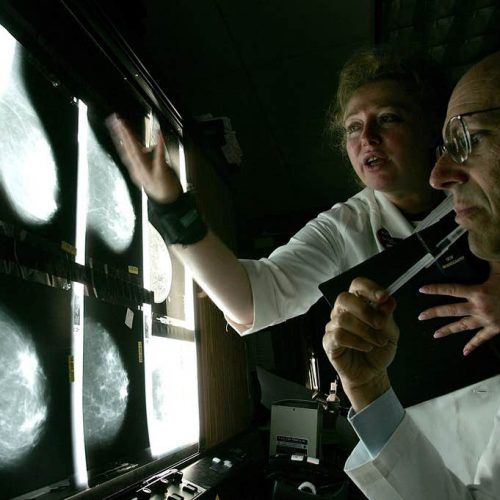 Verwoestend rapport over nadelen en gebrek aan effectiviteit van mammografie