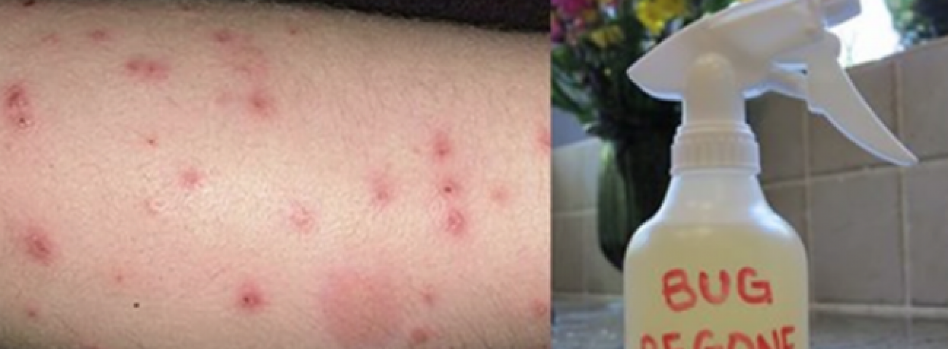 Een zelfgemaakte, niet-giftige muggenspray maken die werkt!