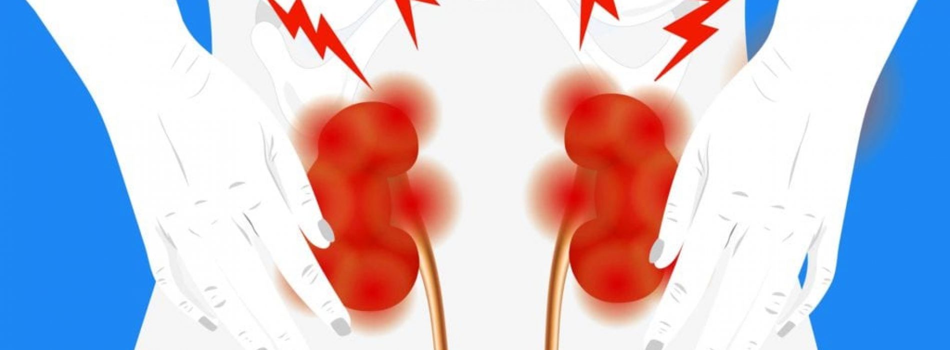 Kan jicht het risico op nieraandoeningen verhogen?