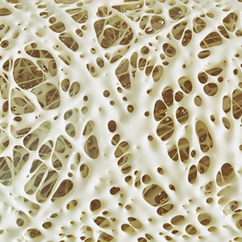 Osteoporose en mannen: farmaceutische producten kunnen het risico op botbreuken vergroten