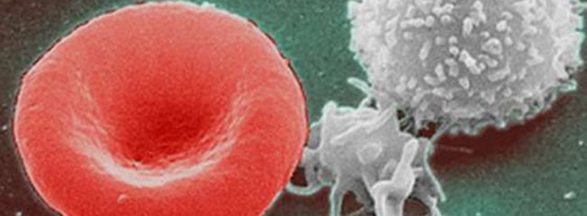 USC-onderzoekers ontdekken hoe ze het volledige immuunsysteem binnen 72 uur kunnen regenereren