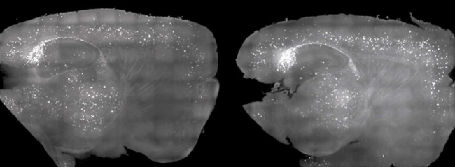 Wetenschappers hebben de plak van Alzheimer van muizen verwijderd met niets anders dan licht en geluid