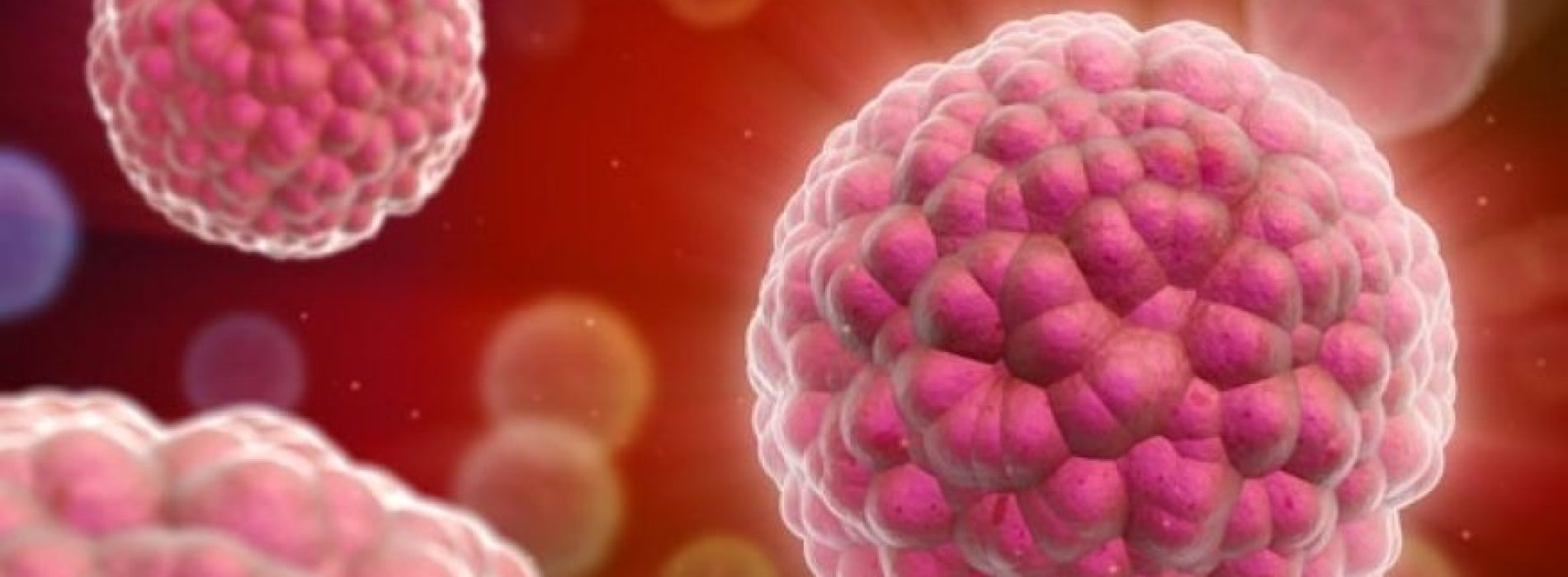 Gerichte echografie vernietigt kankercellen: onderzoek
