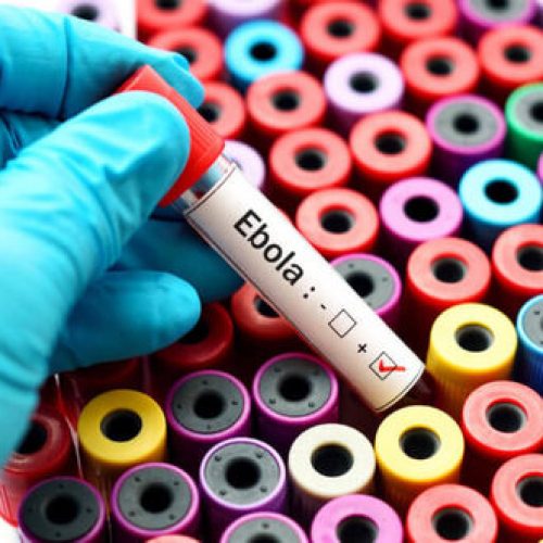 Ebola kan helpen bij het bestrijden van hersentumoren – studie