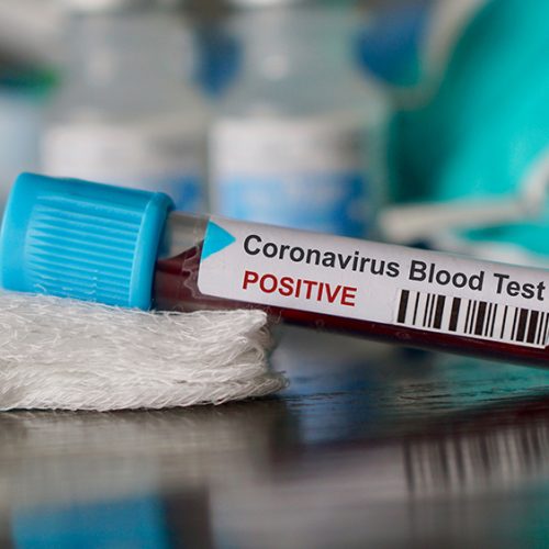 Nieuwe studie zegt dat mensen met bloedgroep A meer kans hebben om het coronavirus op te lopen