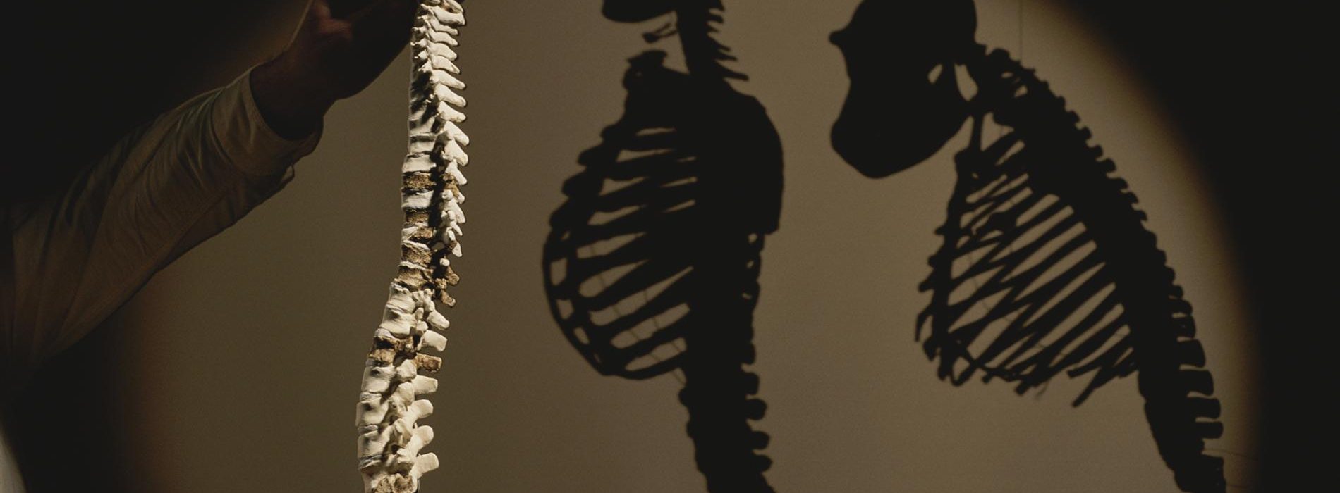 Uw rugpijn kan te wijten zijn aan evolutie en wervelkolomvorm