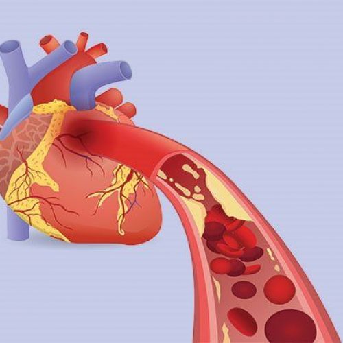 Verlaag het risico op coronaire hartziekte met de helft met één EENVOUDIGE handeling
