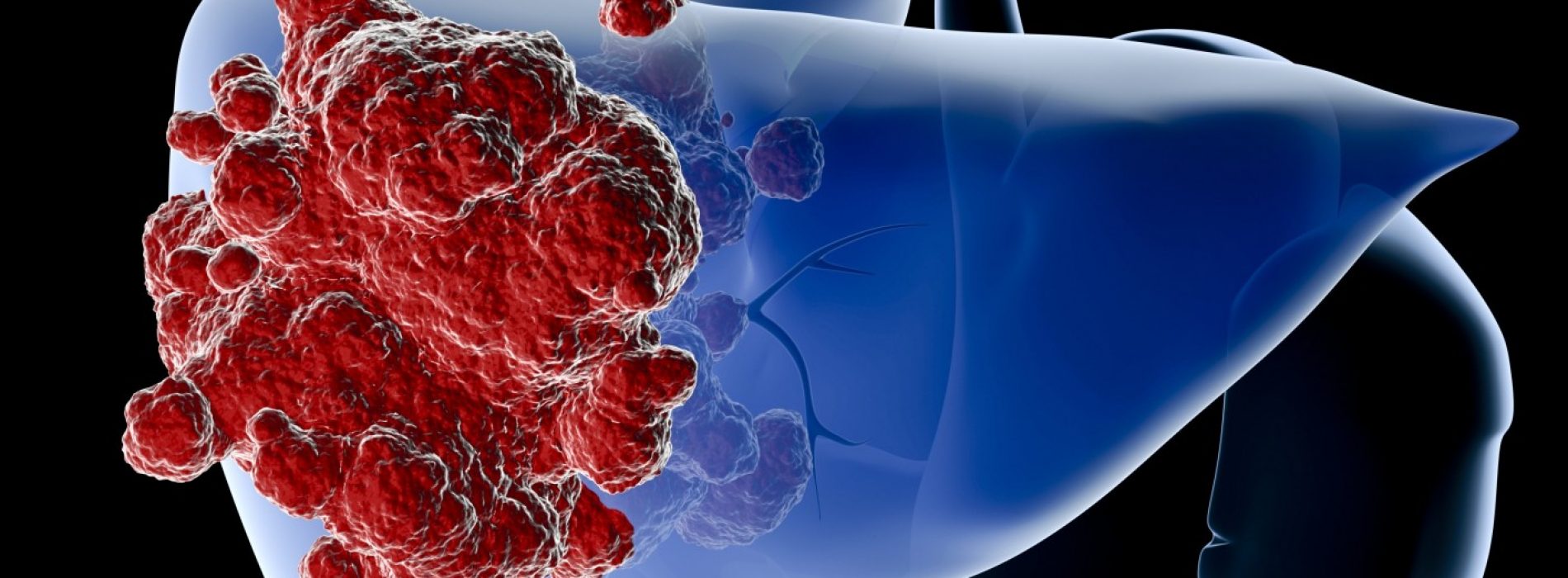 Studie onthult SCHOKKEND verband tussen voor altijd chemicaliën en leverkanker