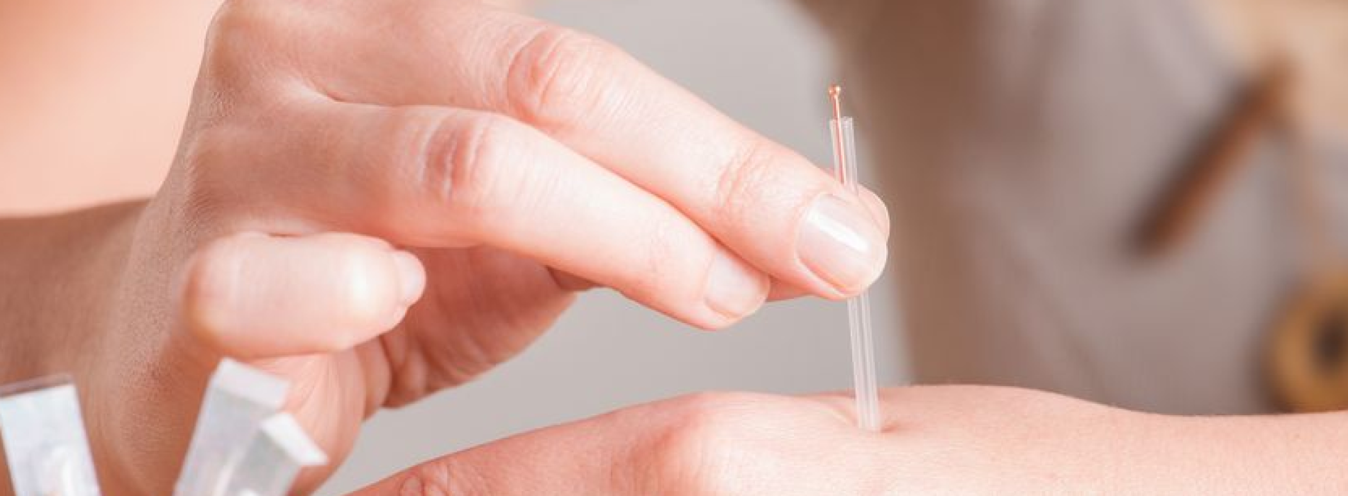 Baanbrekend onderzoek: acupunctuur verslaat geïnjecteerde morfine tegen pijn